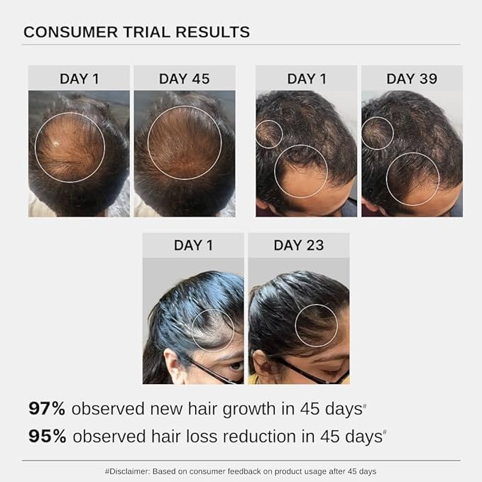 Bare Anatomy Advanced Hair Growth Serum Women & Men | 3% Redensyl + 4% Anagain + 3% Baicapil + 1% Capilia Longa, Rosemary, Biotin & Rice Extract