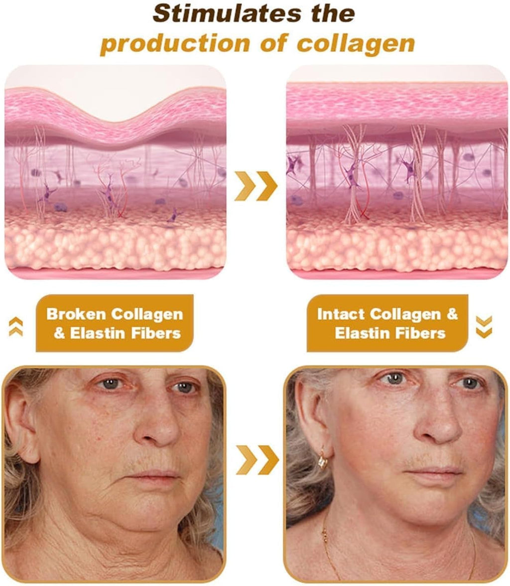 Botox Bee Venom Cream,Anti-Aging Bee Cream- Wrinkle Removal & Firming, Moisturizing, Lifting & Recovery- All Skin Types