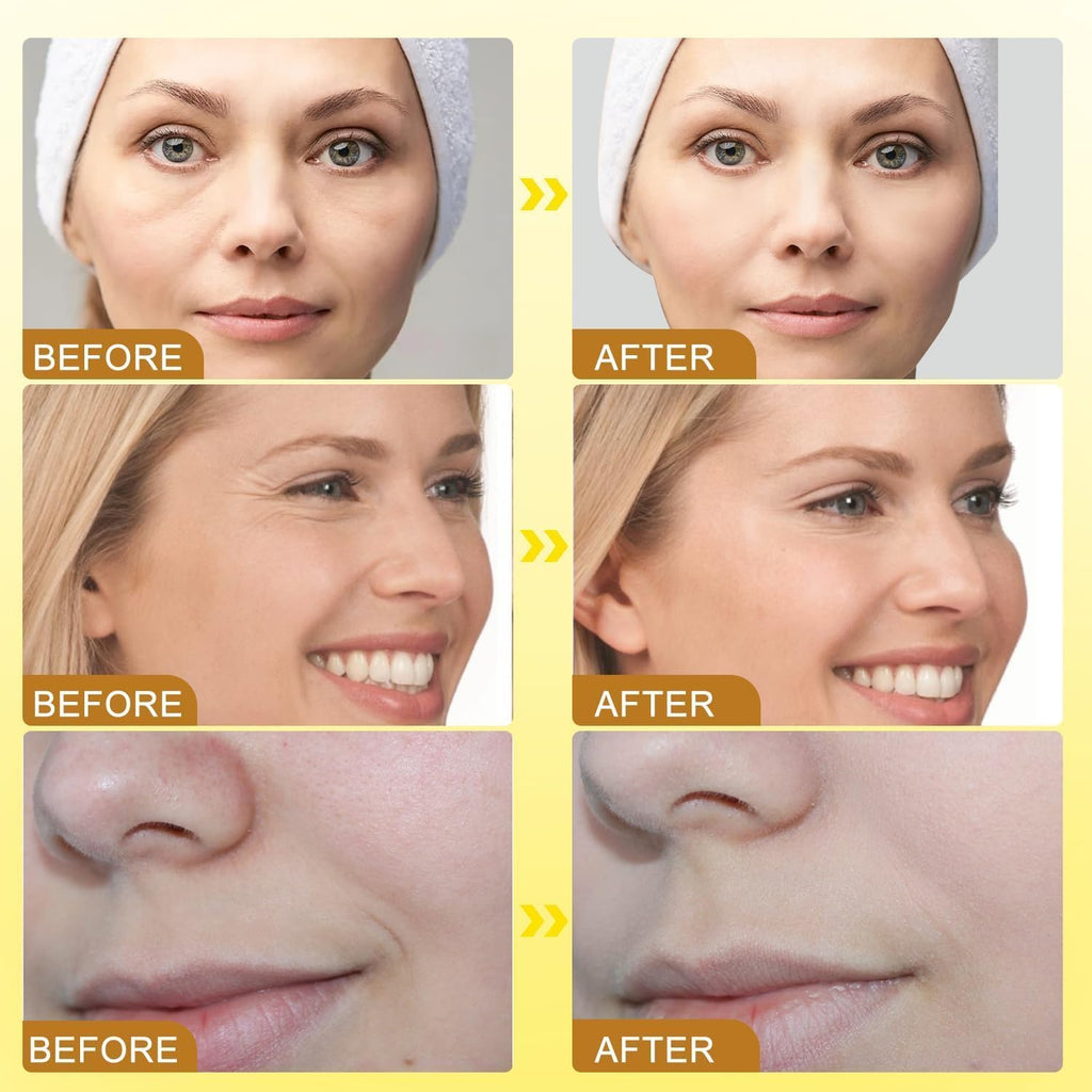Botox Bee Venom Cream,Anti-Aging Bee Cream- Wrinkle Removal & Firming, Moisturizing, Lifting & Recovery- All Skin Types