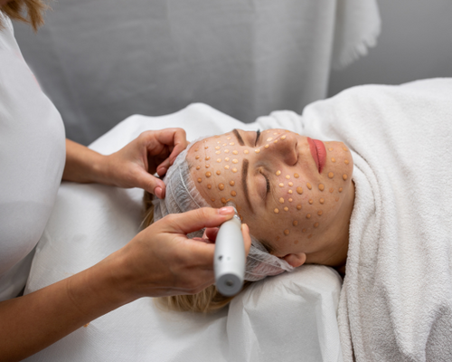 Acne Treatment