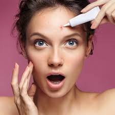 Acne Treatment