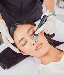 Hydra Facial